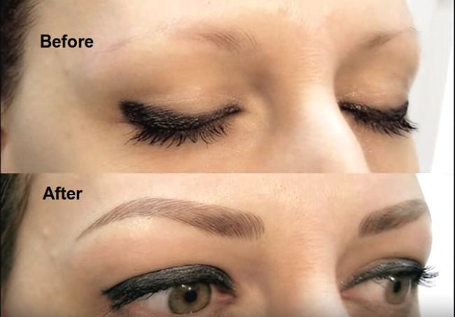 Microblading is a semi-permanent tattooing process using inks and pigments to create extra hair lines to thicken and shape your eyebrows