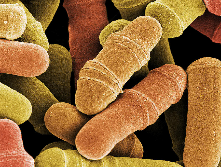 Microscopic view of yeast cells