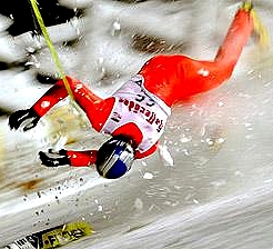 Skiing injuries are rare but can be devasting when head injuries are involved