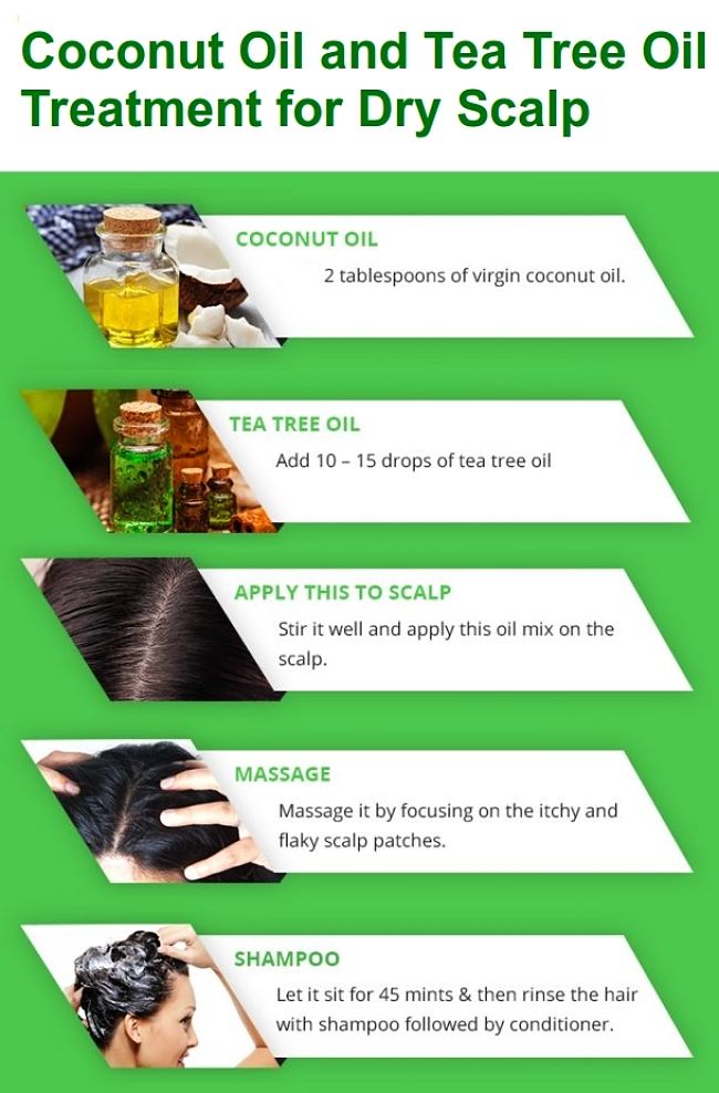 Itchy natural and scalp for home dandruff remedies 10 Natural