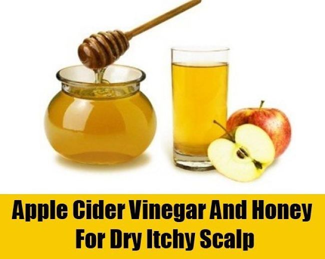 Apple cider and honey scalp rub for relieving symptoms of dry scalp